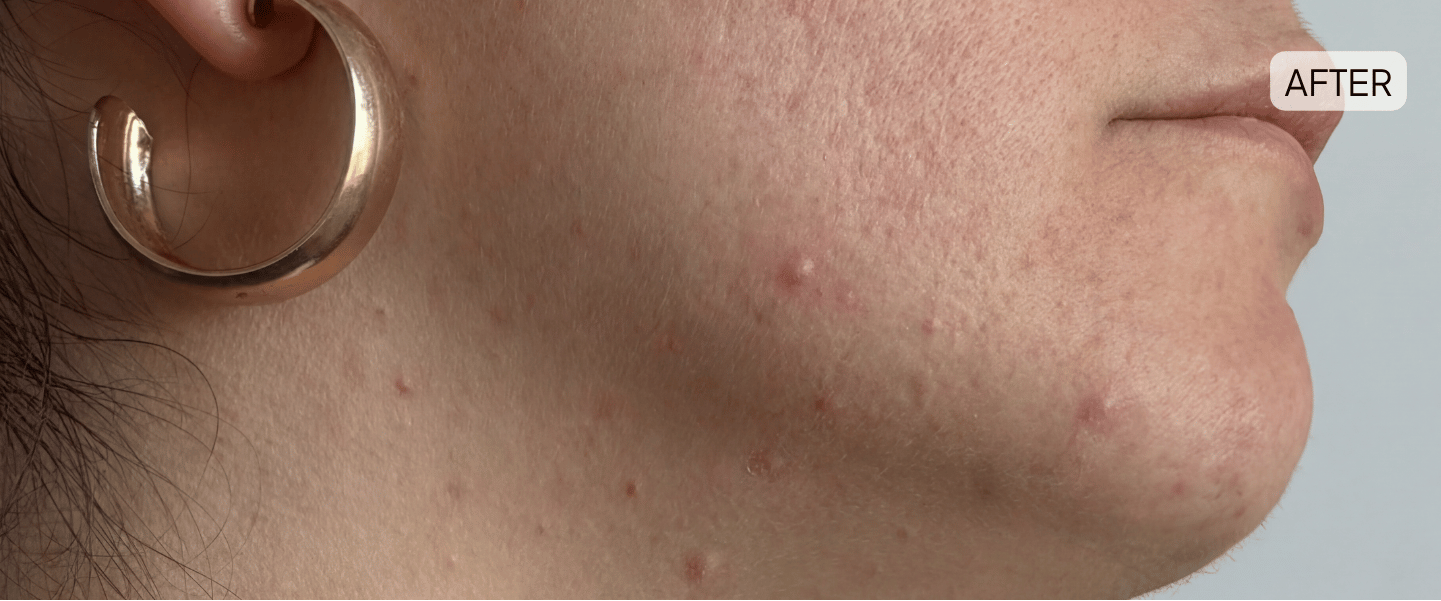 After image